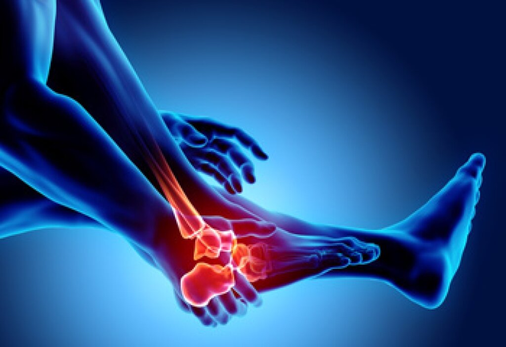 Information on Foot Stress Fractures
