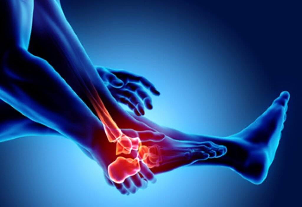Understanding Osteoarthritis of the Ankle